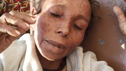 সিলেটে গুরুতর অসুস্থ অবস্থায় বৃদ্ধ মহিলা পাওয়া গেছে